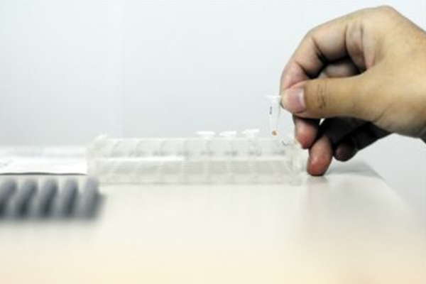 亲子鉴定什么时候做更合适