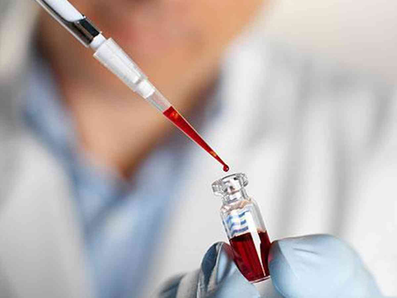 长春哪家医院可以做亲子鉴定?费用是多少?