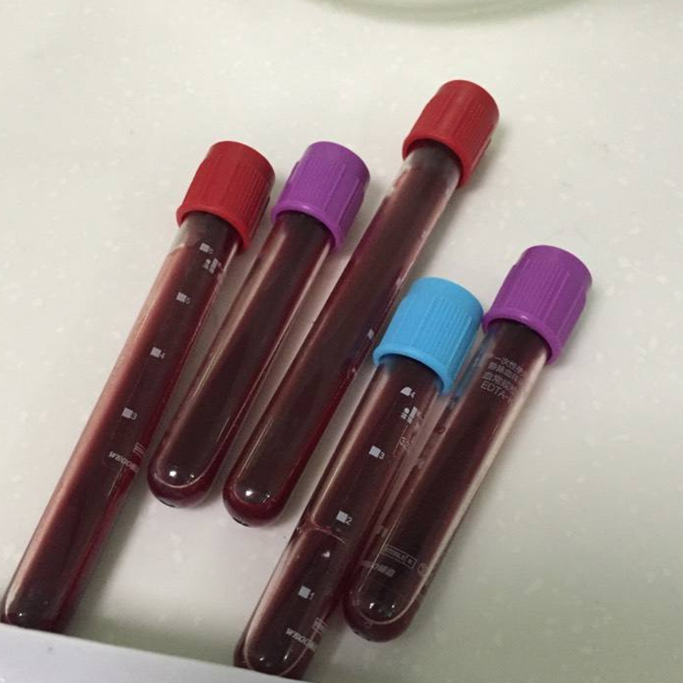 东莞哪个医院可以做亲子鉴定?做亲子鉴定的机构什么时候上班?