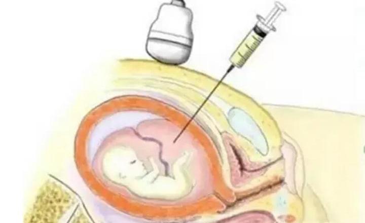 无创亲子鉴定无创亲子鉴定亲子鉴定多少钱?无创亲子鉴定无创亲子鉴定会带来什么风险?
