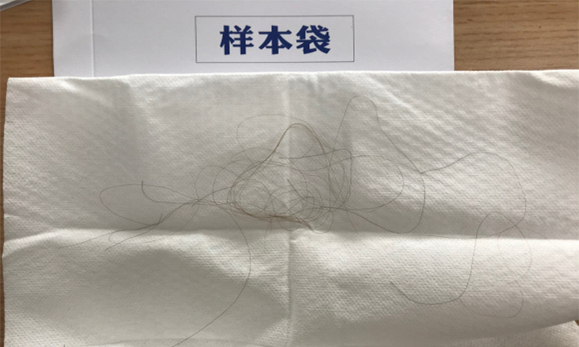 洛阳亲子鉴定在哪个医院可以做呢?亲子鉴定会对人产生危害吗?
